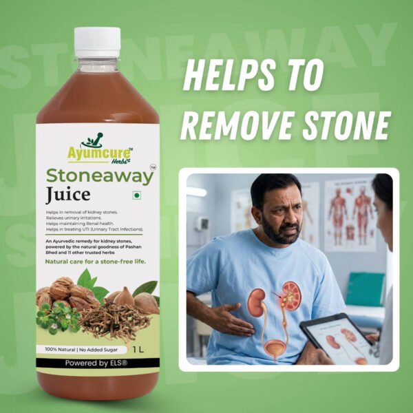 Supports Kidney Stone Removal